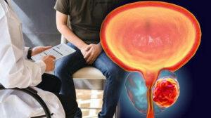 Intimacy After Prostate Cancer