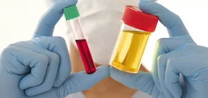 What is Haematuria