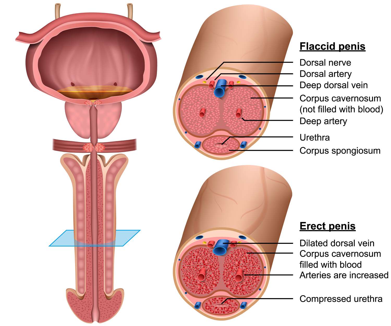 Medical diagram showing three views of penile anatomy: a longitudinal section and two cross-sections comparing flaccid and erect states. Labeled structures include blood vessels, nerves, and erectile tissues. The illustration demonstrates how blood flow changes affect tissue structure.